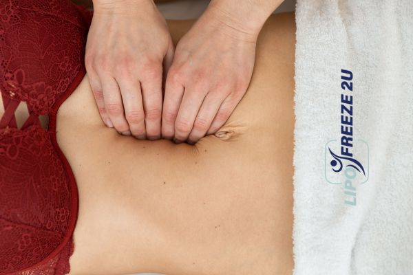 diastasis recti treatment Staffordshire