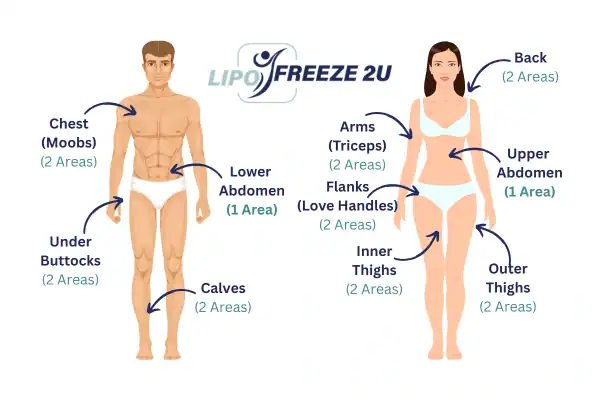 Areas you can have fat freezing treatment Staffordshire