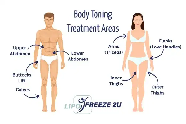 Graphic showing where you can have Body toning Treatment Staffordshire on your body