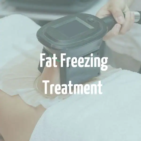 fat freezing treatment Staffordshire