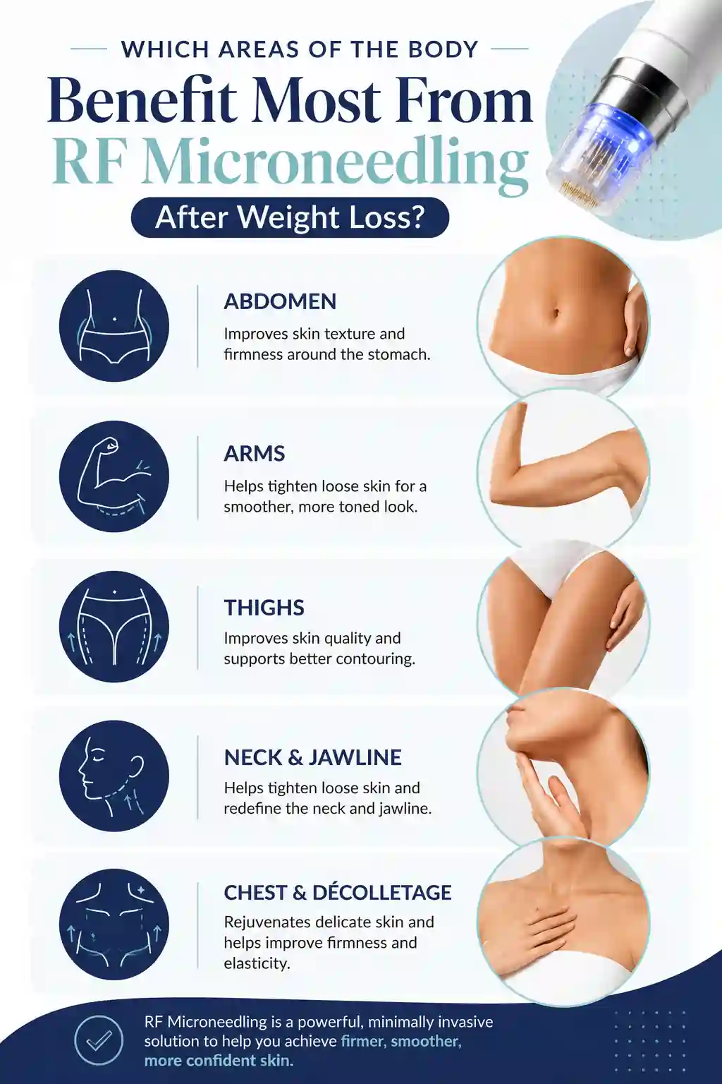 Which Areas of the Body Benefit Most From RF Microneedling After Weight Loss Staffordshire