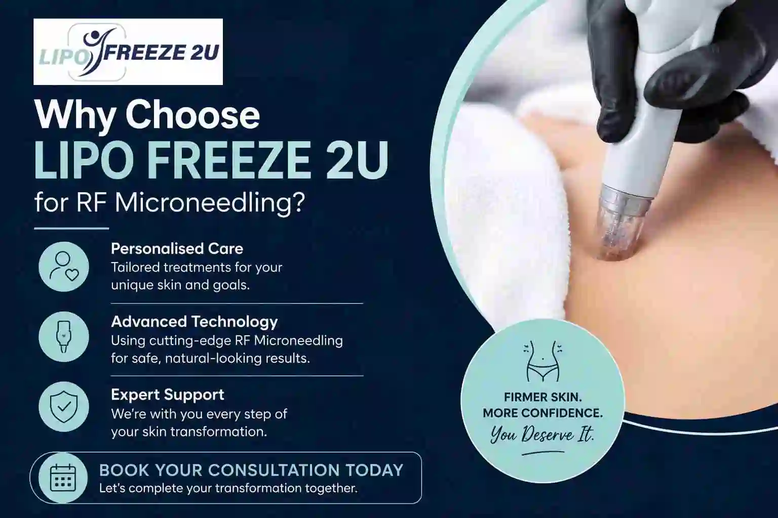 Why Choose LIPO FREEZE 2U for RF Microneedling Staffordshire?